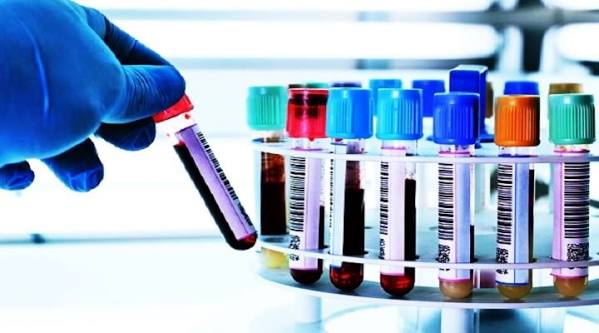 Lab Services